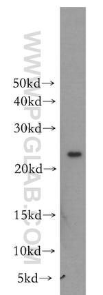 MTHFS Antibody in Western Blot (WB)