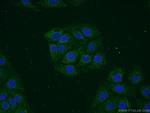 VAMP1 Antibody in Immunocytochemistry (ICC/IF)