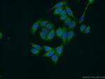 ZFYVE16 Antibody in Immunocytochemistry (ICC/IF)