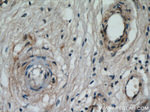 ZFYVE16 Antibody in Immunohistochemistry (Paraffin) (IHC (P))