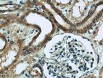 ZFYVE16 Antibody in Immunohistochemistry (Paraffin) (IHC (P))