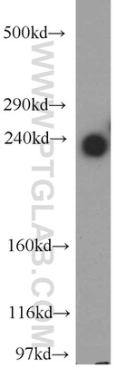 ZFYVE16 Antibody in Western Blot (WB)