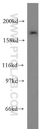 ZFYVE16 Antibody in Western Blot (WB)