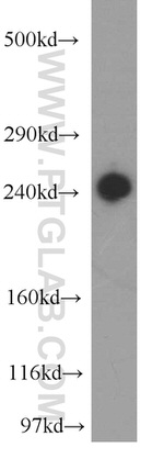 ZFYVE16 Antibody in Western Blot (WB)