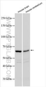 PDE1B Antibody in Western Blot (WB)