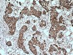 ACADSB Antibody in Immunohistochemistry (Paraffin) (IHC (P))