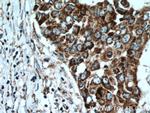 ACADSB Antibody in Immunohistochemistry (Paraffin) (IHC (P))