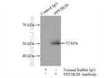 PPP2R2B Antibody in Immunoprecipitation (IP)