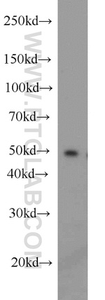 PPP2R2B Antibody in Western Blot (WB)