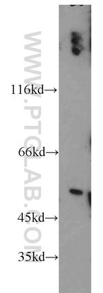 PPP2R2B Antibody in Western Blot (WB)