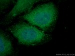 USP24 Antibody in Immunocytochemistry (ICC/IF)