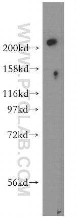 USP24 Antibody in Western Blot (WB)