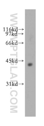 FDFT1 Antibody in Western Blot (WB)