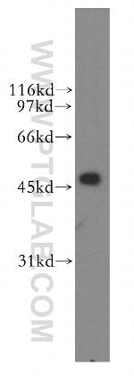 FDFT1 Antibody in Western Blot (WB)