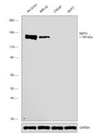 NEFH Antibody in Western Blot (WB)