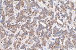 ULBP2 Antibody in Immunohistochemistry (Paraffin) (IHC (P))