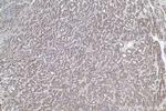 ULBP2 Antibody in Immunohistochemistry (Paraffin) (IHC (P))