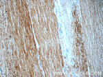 MINK1 Antibody in Immunohistochemistry (Paraffin) (IHC (P))