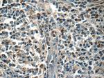 MINK1 Antibody in Immunohistochemistry (Paraffin) (IHC (P))