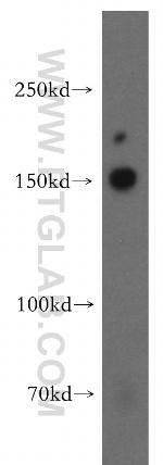 MINK1 Antibody in Western Blot (WB)