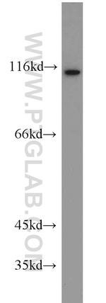 FOXM1 Antibody in Western Blot (WB)