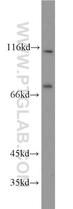 FOXM1 Antibody in Western Blot (WB)