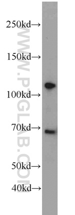 FOXM1 Antibody in Western Blot (WB)