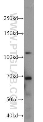 FOXM1 Antibody in Western Blot (WB)