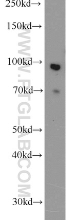 FOXM1 Antibody in Western Blot (WB)