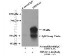 FBXW11 Antibody in Immunoprecipitation (IP)