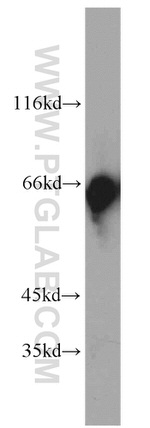 FBXW11 Antibody in Western Blot (WB)