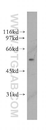 UGDH Antibody in Western Blot (WB)