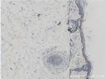 ST3GAL6 Antibody in Immunohistochemistry (Paraffin) (IHC (P))