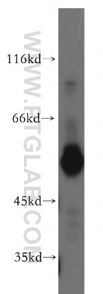 ST3GAL6 Antibody in Western Blot (WB)