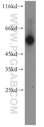 ST3GAL6 Antibody in Western Blot (WB)