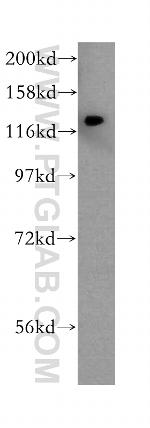 DHX36 Antibody in Western Blot (WB)