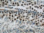 SIRT1 Antibody in Immunohistochemistry (Paraffin) (IHC (P))