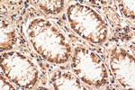 SIRT1 Antibody in Immunohistochemistry (Paraffin) (IHC (P))