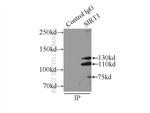 SIRT1 Antibody in Immunoprecipitation (IP)