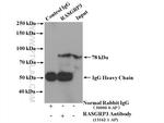 RASGRP3 Antibody in Immunoprecipitation (IP)