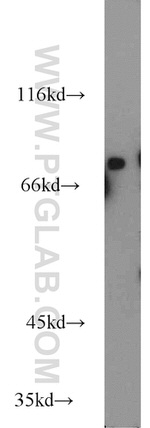 RASGRP3 Antibody in Western Blot (WB)