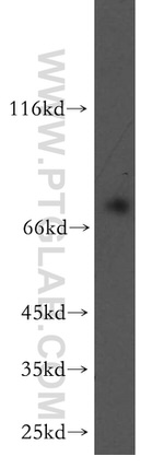 RASGRP3 Antibody in Western Blot (WB)