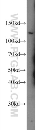 PSMA/GCPII Antibody in Western Blot (WB)