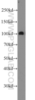 PSMA/GCPII Antibody in Western Blot (WB)