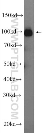 PSMA/GCPII Antibody in Western Blot (WB)