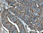 PSMA/GCPII Antibody in Immunohistochemistry (Paraffin) (IHC (P))