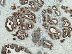 PSMA/GCPII Antibody in Immunohistochemistry (Paraffin) (IHC (P))