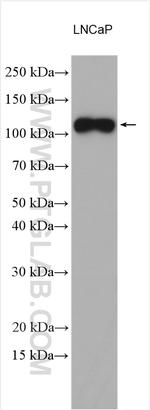 PSMA/GCPII Antibody in Western Blot (WB)