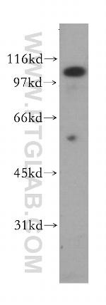 PSMA/GCPII Antibody in Western Blot (WB)