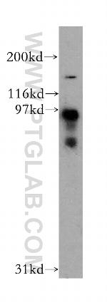 DCBLD2 Antibody in Western Blot (WB)